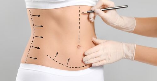 健康・医学 aesthetic plastic surgery of the east Aesthetic Plastic Surgery of the East Asian Face